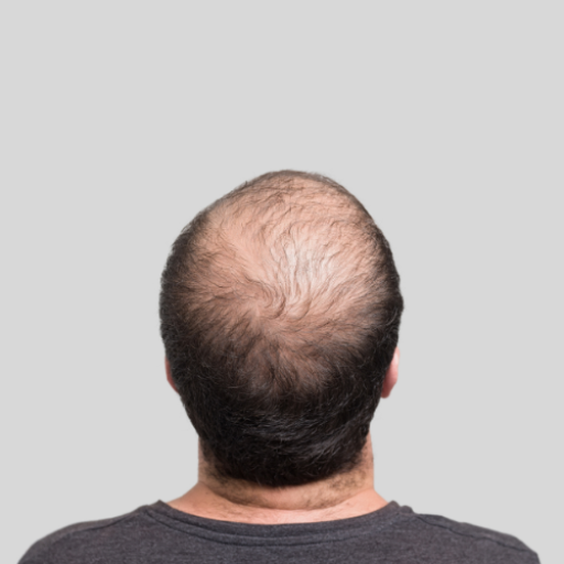 logo of Hair Loss Advisor on the GPT Store